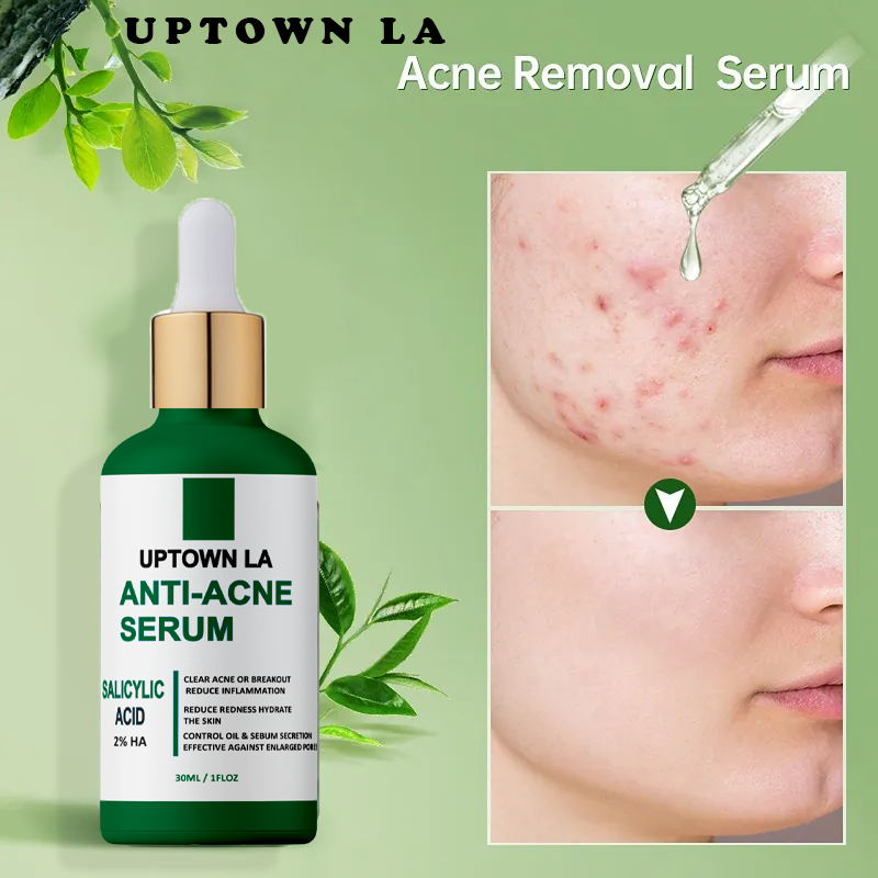 UPTOWN LA Anti Acne serum 30 ML